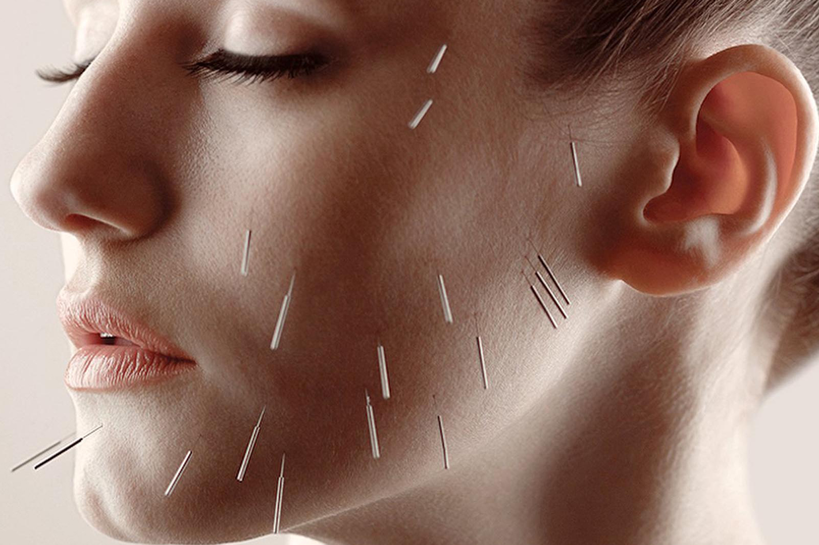 Acupuncture Facial Rejuvenation